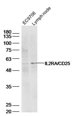 IL2RA Rabbit anti-Human, Polyclonal, Bioss 100 &mu;L; Unconjugated:Antibodies,