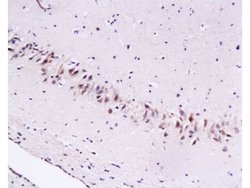 Cytoglobin Rabbit anti-Human, Polyclonal, Bioss 100 &mu;L; Unconjugated:Antibodies,