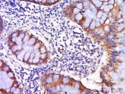 DR4 Rabbit anti-Human, Polyclonal, Bioss 100 &mu;L; Unconjugated:Antibodies,