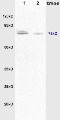 DVL1 Rabbit anti-Human, Polyclonal, Bioss 100 &mu;L; Unconjugated:Antibodies,