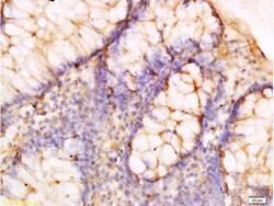 Adiponectin receptor 2 Polyclonal Antibody, Bioss 100 &mu;L; Unconjugated:Antibodies,