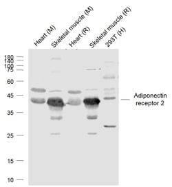 Adiponectin receptor 2 Polyclonal Antibody, Bioss 100 &mu;L; Unconjugated:Antibodies,
