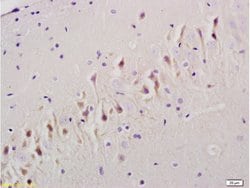TGF beta Receptor 1 Rabbit anti-Human, Polyclonal, Bioss 100 &mu;L; Unconjugated:Antibodies,