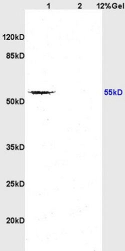 TGF beta Receptor 1 Rabbit anti-Human, Polyclonal, Bioss 100 &mu;L; Unconjugated:Antibodies,