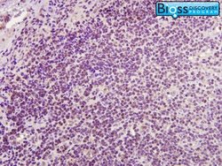 CD4 Rabbit anti-Human, Polyclonal, Bioss 100 &mu;L | Buy Online | Bioss | Fisher Scientific