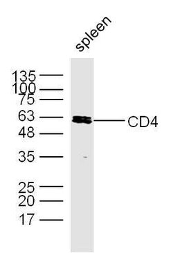 CD4 Rabbit anti-Human, Polyclonal, Bioss 100 &mu;L | Buy Online | Bioss | Fisher Scientific