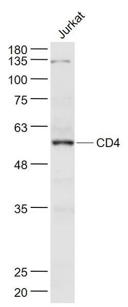CD4 Rabbit anti-Human, Polyclonal, Bioss 100 &mu;L | Buy Online | Bioss | Fisher Scientific