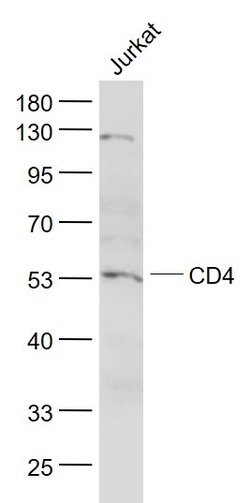 CD4 Rabbit anti-Human, Polyclonal, Bioss 100 &mu;L | Buy Online | Bioss | Fisher Scientific