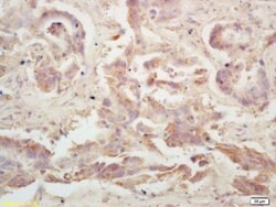 LRP Rabbit anti-Human, Polyclonal, Bioss 100 &mu;L; Unconjugated:Antibodies,