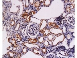 c-Kit Rabbit anti-Human, Polyclonal, Bioss 100 &mu;L; Unconjugated:Antibodies,