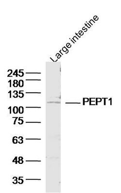 PEPT1 Rabbit anti-Human Mouse Rat, Polyclonal, Bioss 100 &mu;L; Unconjugated:Antibodies,
