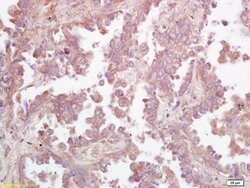 Ceramide glucosyltransferase Rabbit anti-Human, Polyclonal, Bioss 100 &mu;L;