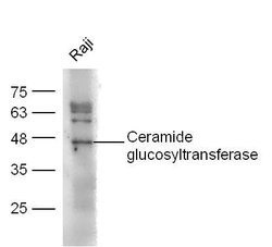 Ceramide glucosyltransferase Rabbit anti-Human, Polyclonal, Bioss 100 &mu;L;