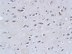 Neurofilament H Rabbit anti-Human, Polyclonal, Bioss 100 &mu;L; Unconjugated:Antibodies,