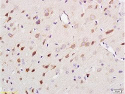 Neurofilament H Rabbit anti-Human, Polyclonal, Bioss 100 &mu;L; Unconjugated:Antibodies,