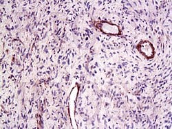 CTGF Rabbit anti-Human, Polyclonal, Bioss 100 &mu;L; Unconjugated:Antibodies,
