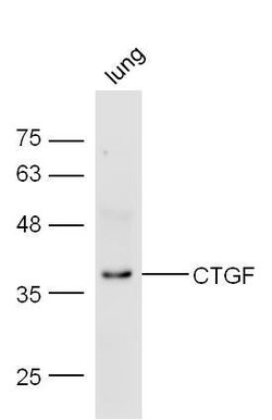 CTGF Rabbit anti-Human, Polyclonal, Bioss 100 &mu;L; Unconjugated:Antibodies,
