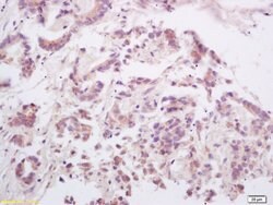 RANKL Rabbit anti-Human, Polyclonal, Bioss 100 &mu;L; Unconjugated:Antibodies,