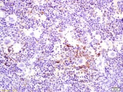 RANKL Rabbit anti-Human, Polyclonal, Bioss 100 &mu;L; Unconjugated:Antibodies,