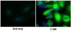 Vimentin Rabbit anti-Human, Polyclonal, Bioss 100 &mu;L; Unconjugated:Antibodies,
