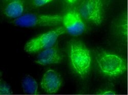 Vimentin Rabbit anti-Human, Polyclonal, Bioss 100 &mu;L; Unconjugated:Antibodies,