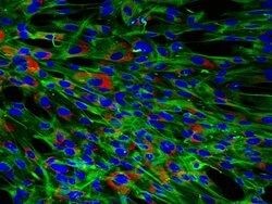 Vimentin Rabbit anti-Human, Polyclonal, Bioss 100 &mu;L; Unconjugated:Antibodies,