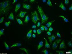Vimentin Rabbit anti-Human, Polyclonal, Bioss 100 &mu;L; Unconjugated:Antibodies,