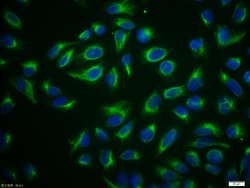 Vimentin Rabbit anti-Human, Polyclonal, Bioss 100 &mu;L; Unconjugated:Antibodies,