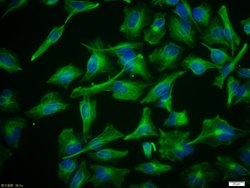 Vimentin Rabbit anti-Human, Polyclonal, Bioss 100 &mu;L; Unconjugated:Antibodies,