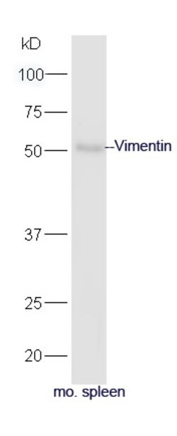 Vimentin Rabbit anti-Human, Polyclonal, Bioss 100 &mu;L; Unconjugated:Antibodies,