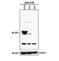 Vimentin Rabbit anti-Human, Polyclonal, Bioss 100 &mu;L; Unconjugated:Antibodies,