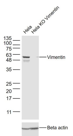 Vimentin Rabbit anti-Human, Polyclonal, Bioss 100 &mu;L; Unconjugated:Antibodies,
