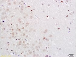 Midnolin Rabbit anti-Human, Polyclonal, Bioss 100 &mu;L; Unconjugated:Antibodies,