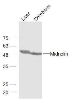 Midnolin Rabbit anti-Human, Polyclonal, Bioss 100 &mu;L; Unconjugated:Antibodies,