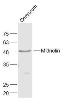 Midnolin Rabbit anti-Human, Polyclonal, Bioss 100 &mu;L; Unconjugated:Antibodies,