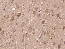 IL-12 alpha Rabbit anti-Human, Polyclonal, Bioss 100 &mu;L; Unconjugated:Antibodies,