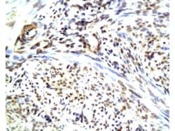 CGRP Rabbit anti-Human, Polyclonal, Bioss 100 &mu;L; Unconjugated:Antibodies,