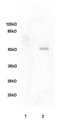 Fibulin 5 Rabbit anti-Human, Polyclonal, Bioss 100 &mu;L; Unconjugated:Antibodies,