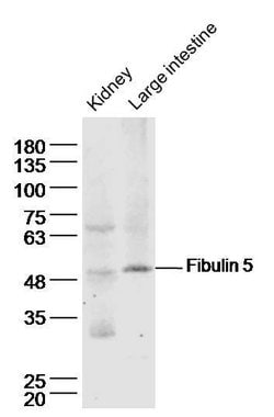 Fibulin 5 Rabbit anti-Human, Polyclonal, Bioss 100 &mu;L; Unconjugated:Antibodies,