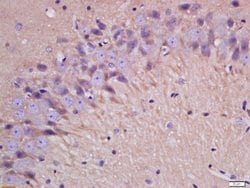 IL-1 Beta Rabbit anti-Human, Polyclonal, Bioss 100 &mu;L; Unconjugated:Antibodies,