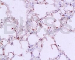 IL-1 Beta Rabbit anti-Human, Polyclonal, Bioss 100 &mu;L; Unconjugated:Antibodies,