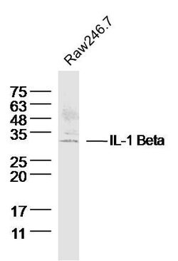 IL-1 Beta Rabbit anti-Human, Polyclonal, Bioss 100 &mu;L; Unconjugated:Antibodies,