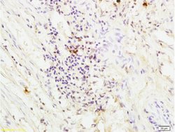 Thrombin receptor Rabbit anti-Human, Polyclonal, Bioss 100 &mu;L; Unconjugated:Antibodies,