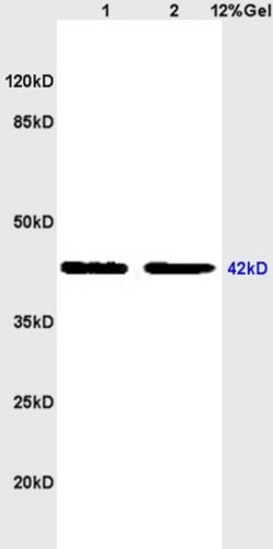 Thrombin receptor Rabbit anti-Human, Polyclonal, Bioss 100 &mu;L; Unconjugated:Antibodies,