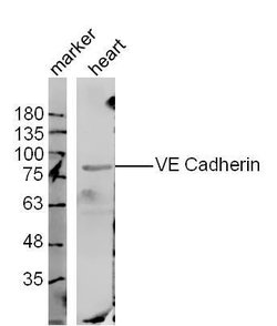 VE Cadherin Rabbit anti-Human, Polyclonal, Bioss 100 &mu;L; Unconjugated:Antibodies,