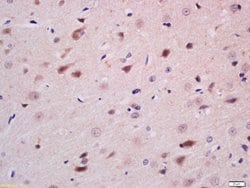 Neurogenin 3 Rabbit anti-Human, Polyclonal, Bioss 100 &mu;L; Unconjugated:Antibodies,