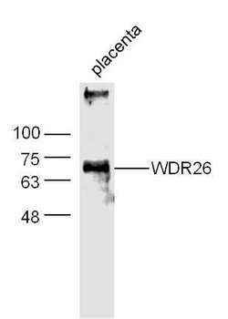 WDR26 Rabbit anti-Human, Polyclonal, Bioss 100 &mu;L; Unconjugated:Antibodies,