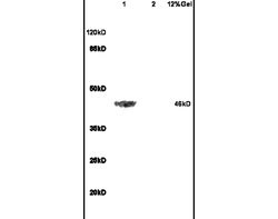 ADRB2 Rabbit anti-Human, Polyclonal, Bioss 100 &mu;L; Unconjugated:Antibodies,