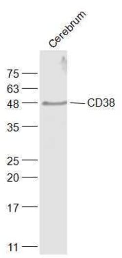 CD38 Rabbit anti-Human, Polyclonal, Bioss 100 &mu;L; Unconjugated:Antibodies,