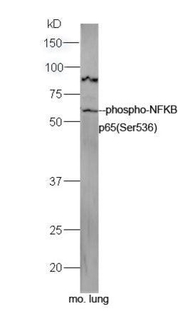 Phospho-NFKB p65 (Ser536) Rabbit anti-Human, Polyclonal, Bioss 100 &mu;L;